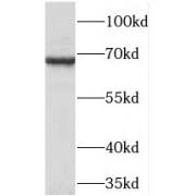 WB analysis of HL-60 cells, using TCIRG1 antibody (1/300 dilution).