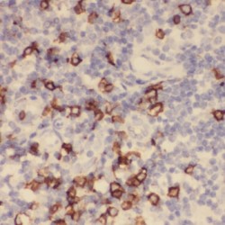 T-Cell Leukemia/lymphoma Protein 1A (TCL1A) Antibody