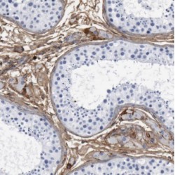 Transcobalamin-1 (TCN1) Antibody