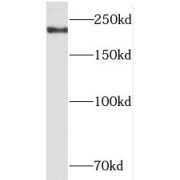 WB analysis of HeLa cells, using TCOF1 antibody (1/1000 dilution).