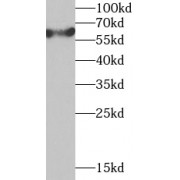 WB analysis of MCF7 cells, using TCP1 antibody (1/1000 dilution).