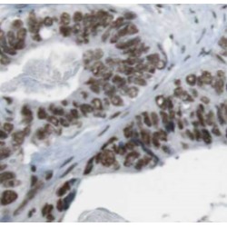 TAR DNA-Binding Protein 43 / TDP43 (TARDBP) Antibody