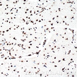 TAR DNA-Binding Protein 43 (TDP-43) Antibody