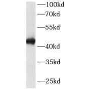 WB analysis of MCF7 cells, using TARDBP antibody (1/10000. dilution).