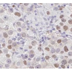 TDRKH specific Antibody