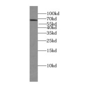 WB analysis of mouse testis tissue, using TDRKH antibody (1/500 dilution).