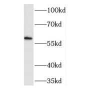WB analysis of mouse colon tissue, using TEAD2 antibody (1/1000 dilution).