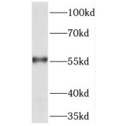 WB analysis of COLO 320 cells, using TEKT5 antibody (1/1000 dilution).