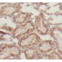 Transcription Factor A, Mitochondrial (TFAM) Antibody