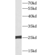 WB analysis of HEK-293 cells, using TFAM antibody (1/1000 dilution).