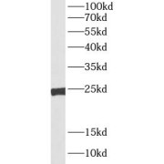 WB analysis of HEK-293 cells, using TFAM antibody (1/1000 dilution).