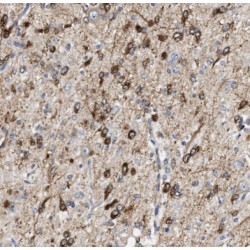 Transcription Factor AP-4 (TFAP4) Antibody
