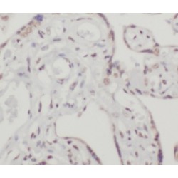 Transcription Factor EB (TFEB) Antibody