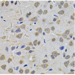 Transglutaminase 1, Keratinocyte (TGM1) Antibody