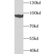 WB analysis of 293T cells, using TGM1 antibody (1/1000 dilution).