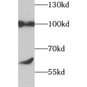 WB analysis of HEK-293 cells, using TSG1 antibody (1/1000 dilution).