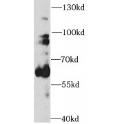 WB analysis of mouse brain tissue, using TH antibody (1/1000 dilution).