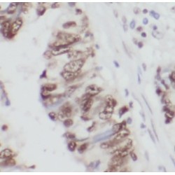 THAP Domain-Containing Protein 1 (THAP1) Antibody