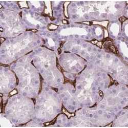 Acyl-Coenzyme A Thioesterase 13 (ACOT13) Antibody