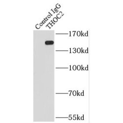 THO Complex 2 (THOC2) Antibody