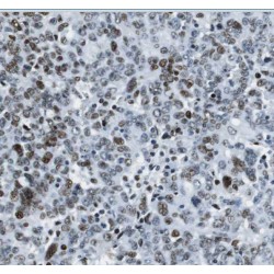 THO Complex 6 (THOC6) Antibody