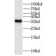 WB analysis of A431 cells, using THOC6 antibody (1/500 dilution).
