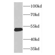 WB analysis of A431 cells, using THRA antibody (1/2000 dilution).