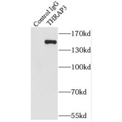 Thyroid Hormone Receptor Associated Protein 3 (THRAP3) Antibody