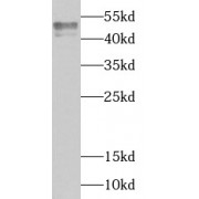 WB analysis of BT-474 cells, using TIA1 antibody (1/1000 dilution).