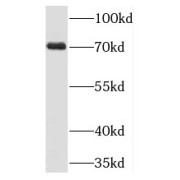 WB analysis of HepG2 cells, using TIGD1 antibody (1/400 dilution).
