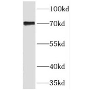 WB analysis of HeLa cells, using TIGD5 antibody (1/300 dilution).