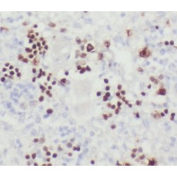 Protein Timeless Homolog (TIMELESS) Antibody