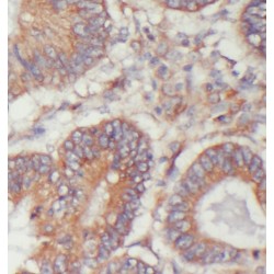 Mitochondrial Import Inner Membrane Translocase Subunit Tim17-B (TIMM17B) Antibody