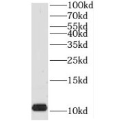 WB analysis of human kidney tissue, using TIMM8A antibody (1/500 dilution).