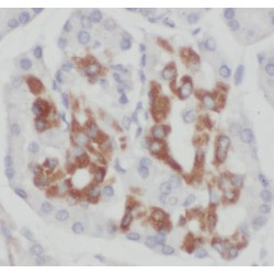 Mitochondrial Import Inner Membrane Translocase Subunit Tim9 (TIMM9) Antibody
