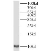 WB analysis of A549 cells, using TIMM9 antibody (1/300 dilution).