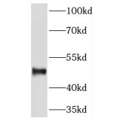 WB analysis of 3T3-L1 cells, using TIP47 antibody (1/2000 dilution).
