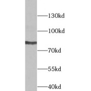WB analysis of 293T cells, using TLK2 antibody (1/1000 dilution).