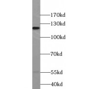 WB analysis of mouse lung tissue, using TLR7 antibody (1/400 dilution).