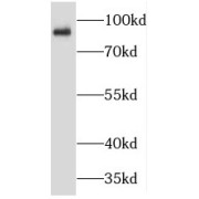 WB analysis of mouse brain tissue, using TMCC2 antibody (1/1000 dilution).