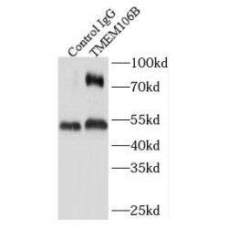Transmembrane Protein 106B (TMEM106B) Antibody