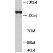 WB analysis of human brain tissue, using TMEM132A antibody (1/500 dilution).