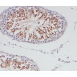 Transmembrane Protein 168 (TMEM168) Antibody