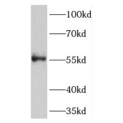 WB analysis of HepG2 cells, using TMEM175 antibody (1/500 dilution).