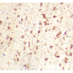 Endosomal/lysomomal Potassium Channel TMEM175 (TMEM175) Antibody