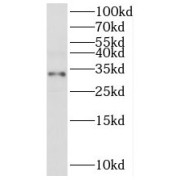 WB analysis of mouse pancreas tissue, using TMEM27 antibody (1/500 dilution).