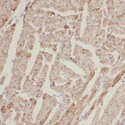 Transmembrane Protein 70 (TMEM70) Antibody