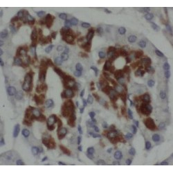Transmembrane Protease Serine 4 (TMPRSS4) Antibody