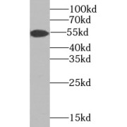 WB analysis of SW 1990 cells, using TMPRSS4 antibody (1/1000 dilution).