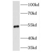WB analysis of rat brain tissue, using TMPRSS5 antibody (1/1000 dilution).